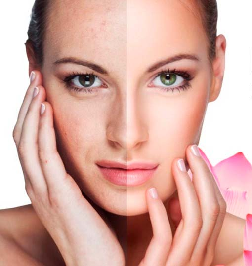 Recuperador hialuronic
